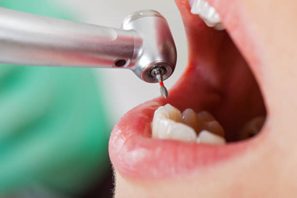 Best Mobile Emergency Dentist in Erie, IL